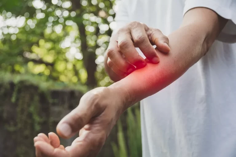 exemples de stimulus inconditionnel